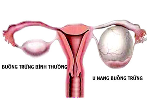 U lang buong trung