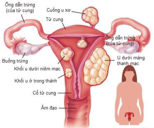U xo tu cung